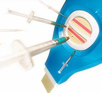 （七）皮下埋植剂&mdash;&mdash;长效避孕法